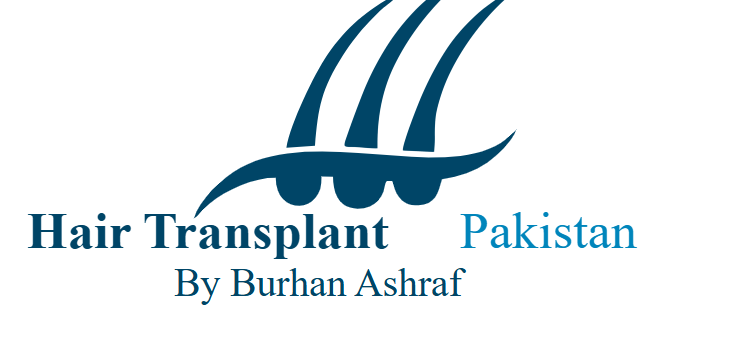hair transplant Pakistan